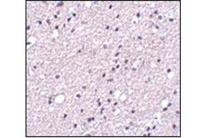 Immunohistochemistry of NK3R in human brain tissue with this product at 5 μg/ml. (TACR3 anticorps  (Center))