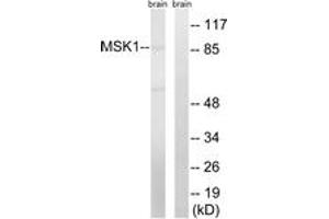 Western blot analysis of extracts from mouse brain cells, using MSK1 (Ab-212) Antibody. (MSK1 anticorps  (AA 181-230))