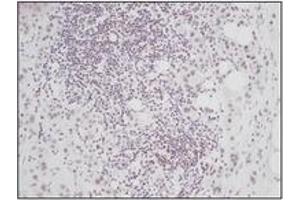 Image no. 1 for anti-Connective Tissue Growth Factor (CTGF) antibody (ABIN181700)