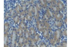 IHC-P analysis of Mouse Kidney Tissue, with DAB staining. (CXCL11 anticorps  (AA 22-100))