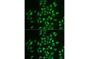 Immunofluorescence analysis of U2OS cells using LNX1 antibody (ABIN5973876). (LNX1 anticorps)