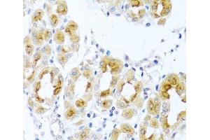 Immunohistochemistry of paraffin-embedded Human stomach using TDGF1 Polyclonal Antibody at dilution of 1:100 (40x lens). (TDGF1 anticorps)