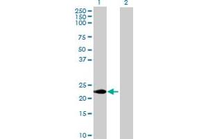 Western Blot analysis of CABP7 expression in transfected 293T cell line by CABP7 MaxPab polyclonal antibody. (CABP7 anticorps  (AA 1-215))