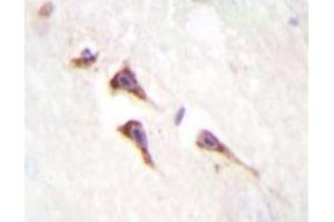 Immunohistochemistry analyzes of mTOR antibody in paraffin-embedded human brain tissue. (MTOR anticorps)