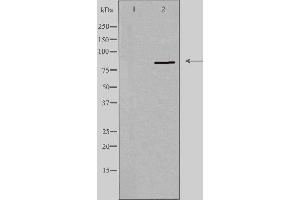 Western blot analysis of extracts from HeLa cells using PNPLA8 antibody.