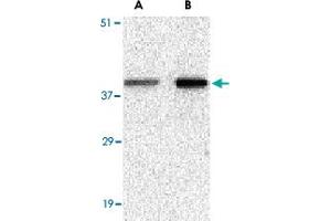 Western blot analysis of BCL2A1 in mouse kidney tissue lysate with BCL2A1 polyclonal antibody  at (A) 1 and (B) 2 ug/mL . (BCL2A1 anticorps  (N-Term))