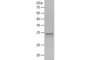 Western Blotting (WB) image for Islet Amyloid Polypeptide (IAPP) (AA 34-70) protein (His-IF2DI Tag) (ABIN7123638)