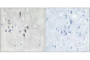 Immunohistochemistry analysis of paraffin-embedded human brain tissue, using CaMK2 alpha/delta (Ab-286) Antibody. (CaMK2 alpha/delta anticorps  (AA 256-305))