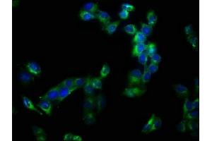 Immunofluorescence staining of Hela cells with ABIN7150034 at 1:133, counter-stained with DAPI. (A Disintegrin and Metallopeptidase Domain 1a (ADAM1A) (AA 214-504) anticorps)