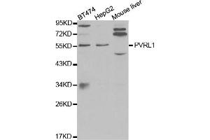 Western blot analysis of extracts of various cell lines, using PVRL1 antibody (ABIN5971069) at 1/1000 dilution. (PVRL1 anticorps)