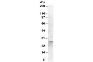 Western blot testing of human cerebellum lysate with OTUB2 antibody at 1ug/ml. (OTUB2 anticorps)
