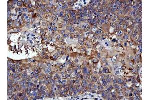 IHC analysis of RRS1 using anti-RRS1 antibody (ABIN7602918).