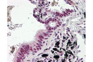 Image no. 1 for anti-DnaJ (Hsp40) Homolog, Subfamily C, Member 3 (DNAJC3) (AA 270-462) antibody (ABIN467547)