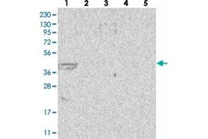 Western blot analysis of Lane 1: RT-4, Lane 2: U-251 MG, Lane 3: Human Plasma, Lane 4: Liver, Lane 5: Tonsil with LIPT1 polyclonal antibody . (LIPT1 anticorps)