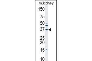 Western blot analysis of anti-DGUOK Pab (ABIN391122 and ABIN2841249) in mouse kidney tissue lysate (35 μg/lane). (Deoxyguanosine Kinase anticorps  (N-Term))