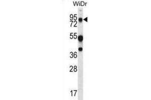 Western Blotting (WB) image for anti-Mucin 20, Cell Surface Associated (MUC20) antibody (ABIN2995266) (MUC20 anticorps)