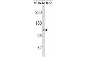 EN Antibody (C-term) (ABIN1881297 and ABIN2838760) western blot analysis in MDA-M cell line lysates (35 μg/lane). (ENPP3 anticorps  (C-Term))