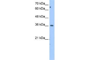 WB Suggested Anti-MDH1 Antibody Titration:  2. (MDH1 anticorps  (Middle Region))