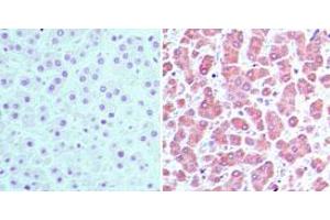 Image no. 1 for anti-Cellular Retinoic Acid Binding Protein 2 (CRABP2) (AA 75-125) antibody (ABIN960117)