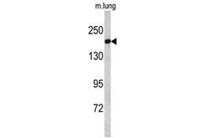 Image no. 1 for anti-Amyotrophic Lateral Sclerosis 2 (Juvenile) (ALS2) (C-Term) antibody (ABIN452733) (ALS2 anticorps  (C-Term))