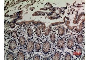 Immunohistochemistry (IHC) analysis of paraffin-embedded Human Colon, antibody was diluted at 1:100. (TRPV3 anticorps  (Internal Region))