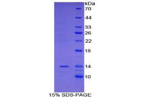 SDS-PAGE (SDS) image for R-Spondin 1 (RSPO1) (AA 21-135) protein (His tag) (ABIN1878272)