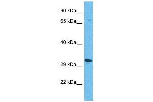 Western Blotting (WB) image for anti-Olfactory Receptor, Family 5, Subfamily AP, Member 2 (OR5AP2) (C-Term) antibody (ABIN2791746) (OR5AP2 anticorps  (C-Term))