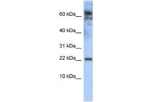 WB Suggested Anti-LDOC1 Antibody Titration:  0. (LDOC1 anticorps  (N-Term))