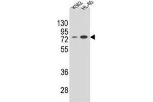 Western Blotting (WB) image for anti-Ectonucleoside Triphosphate diphosphohydrolase 3 (ENTPD3) antibody (ABIN2995799) (ENTPD3 anticorps)