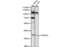 Western blot analysis of extracts of various cell lines, using TMEM59 antibody (ABIN7270968) at 1:1000 dilution.