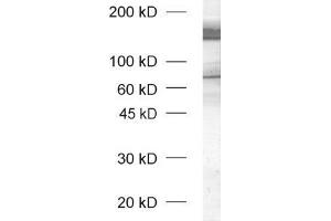dilution: 1 : 1000, sample: rat brain honogenate (unboiled sample) (Neurexin 1 anticorps  (AA 1328-1421))