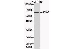 Western Blotting (WB) image for anti-Phospholipase A2, Group IVA (Cytosolic, Calcium-Dependent) (PLA2G4A) antibody (ABIN1874154) (PLA2G4A anticorps)