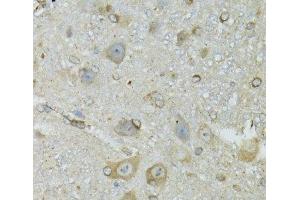 Immunohistochemistry of paraffin-embedded Mouse brain using CRYM Polyclonal Antibody at dilution of 1:100 (40x lens). (CRYM anticorps)