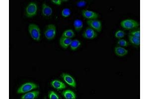 Immunofluorescent analysis of A549 cells using ABIN7153347 at dilution of 1:100 and Alexa Fluor 488-congugated AffiniPure Goat Anti-Rabbit IgG(H+L) (GPR4 anticorps  (AA 285-362))