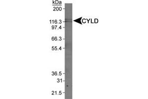 Western blot analysis of CYLD in Jurkat whole cell extract using CYLD polyclonal antibody .