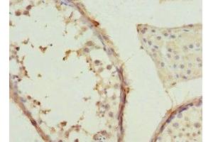 Immunohistochemistry of paraffin-embedded human testis tissue using ABIN7171416 at dilution of 1:100 (CCT2 anticorps  (AA 206-535))