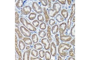 Immunohistochemistry of paraffin-embedded rat testis using PIWIL4 Rabbit pAb (ABIN6132982, ABIN6145704, ABIN6145705 and ABIN6217111) at dilution of 1:100 (40x lens). (PIWIL4 anticorps  (AA 260-460))