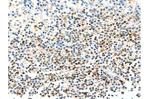 The image on the left is immunohistochemistry of paraffin-embedded Human tonsil tissue using ABIN7129442(FAM3A Antibody) at dilution 1/25, on the right is treated with fusion protein. (FAM3A anticorps)