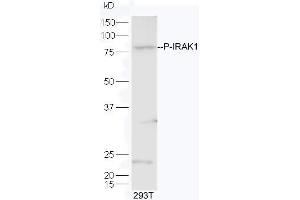 Lane 1:293T lysates probed with Rabbit Anti-IRAK1 (Thr209) Polyclonal Antibody, Unconjugated  at 1:5000 for 90 min at 37˚C.