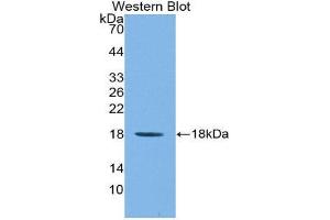 Figure. (IL1F9 anticorps  (AA 5-149))
