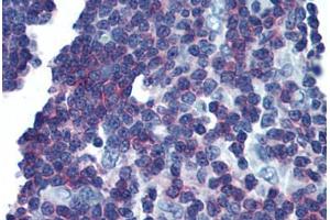 Human Thymus (formalin-fixed, paraffin-embedded) stained with LAT antibody ABIN293627 at 10 ug/ml followed by biotinylated anti-mouse IgG secondary antibody ABIN481714, alkaline phosphatase-streptavidin and chromogen.