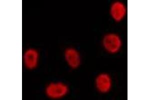 ABIN6274310 staining LOVO by IF/ICC.