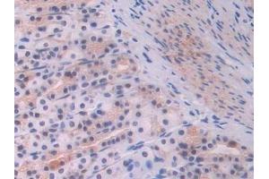 Detection of ENG in Rat Stomach Tissue using Polyclonal Antibody to Endoglin (ENG)