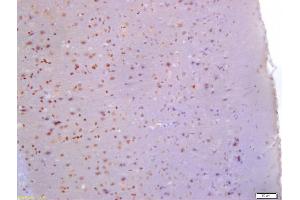 Formalin-fixed and paraffin embedded rat brain labeled with Anti-Glutamine PRPP amidotransferase Polyclonal Antibody, Unconjugated (ABIN872980) at 1:200 followed by conjugation to the secondary antibody and DAB staining (PPAT anticorps  (AA 351-430))