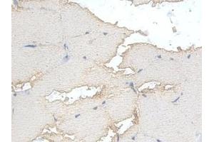 Detection of PFKM in Rat Skeletal muscle Tissue using Polyclonal Antibody to Phosphofructokinase, Muscle (PFKM)