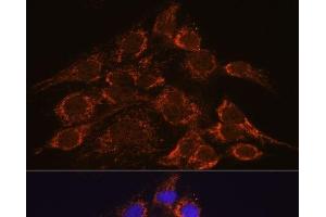 Immunofluorescence analysis of C6 cells using HPS4 Polyclonal Antibody at dilution of 1:100.