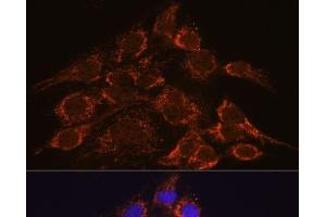 Immunofluorescence analysis of C6 cells using HPS4 Polyclonal Antibody at dilution of 1:100. (HPS4 anticorps)