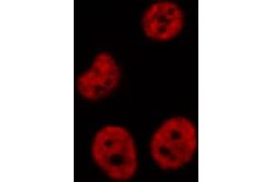 ABIN6274265 staining LOVO cells by IF/ICC.