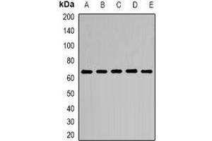 Western blot analysis of CD299 expression in HEK293T (A), Hela (B), NIH3T3 (C), mouse lung (D), mouse heart (E) whole cell lysates. (C-Type Lectin Domain Family 4, Member M (CLEC4M) anticorps)