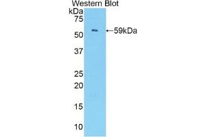 Detection of Recombinant IRF1, Mouse using Polyclonal Antibody to Interferon Regulatory Factor 1 (IRF1)